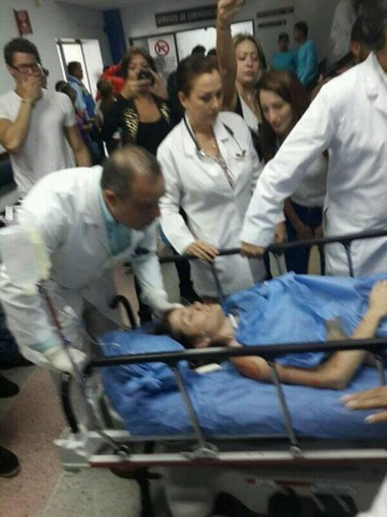  صورة رقم 4 - مصرع ملكة جمال فنزويلية خلال مشاركتها في مظاهرة